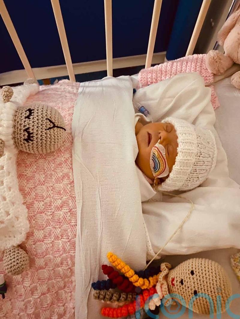 Mum whose baby was born with Down’s syndrome and had surgery for blocked bowel finds miracle cream for painful eczema