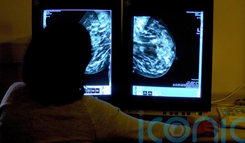 Women urged to attend breast screening to catch cancer early