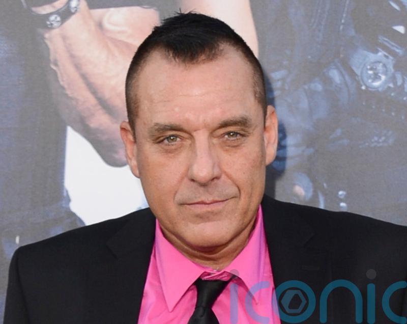 Tom Sizemore in critical condition after brain aneurysm