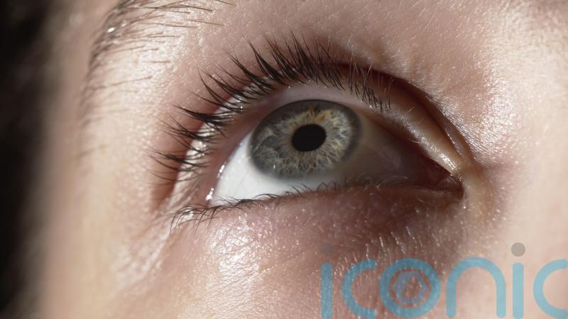 Why won’t my eye stop watering? Yes – it could be early hay fever