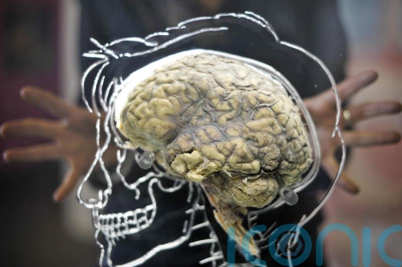 Experts identify link between head injuries and brain tumours
