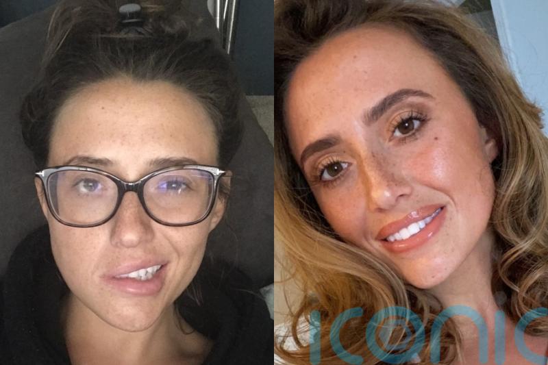 Woman, 29, once nicknamed ‘smiler’ left physically unable to smile after waking up one morning with facial paralysis
