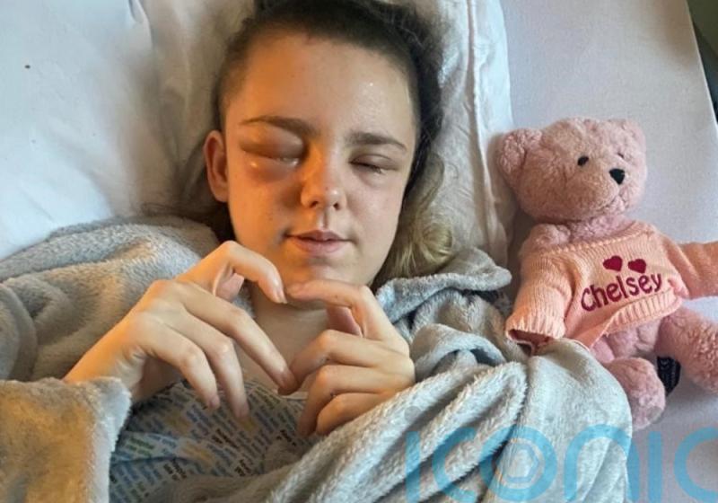 Girl thanks medics after life-saving surgery saw part of skull stored in stomach
