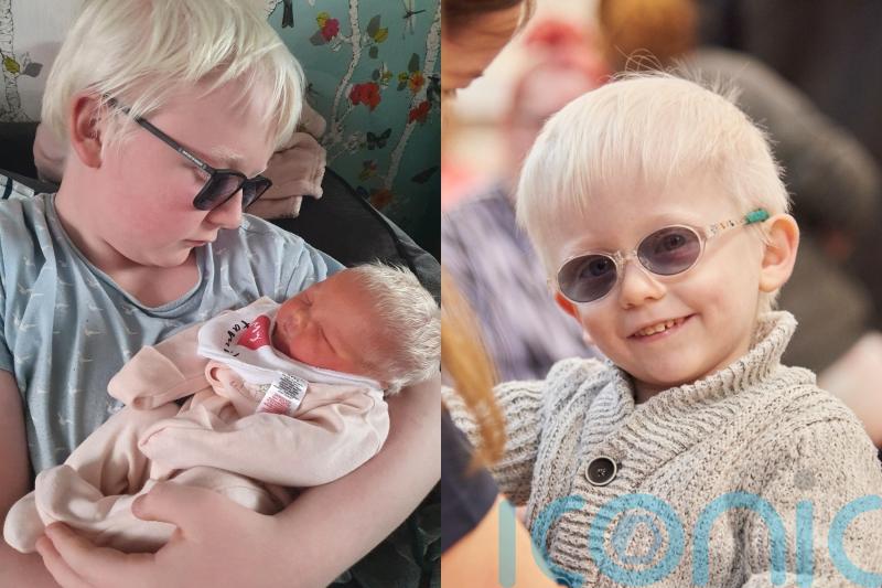 Couple ‘blessed’ to have three children with albinism bemoan ‘rude’ comments and say ‘never judge a book by its cover’