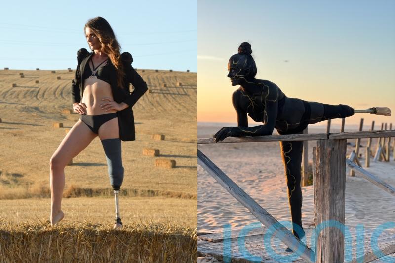 Paralympic dressage hopeful who lost leg after motorbike crash and almost died from injury inspires with gold body paint