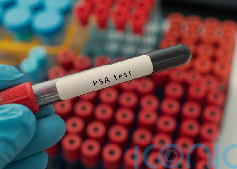 Call to ditch ‘test by request’ approach to prostate cancer care