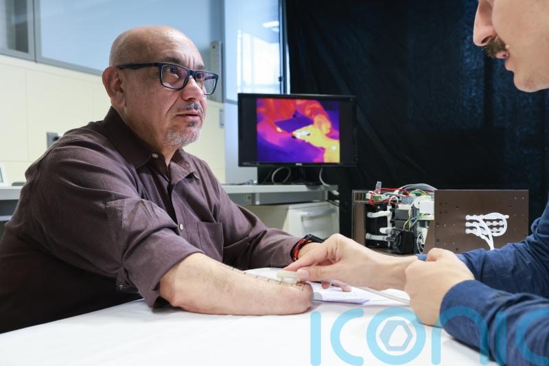 Scientists develop device that allows amputees to feel warmth in phantom hand