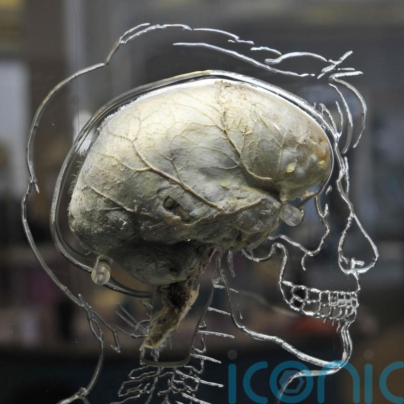 Brain signals can predict how much pain a person is in, research suggests