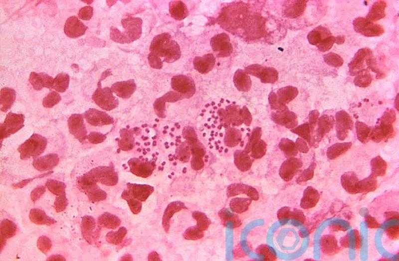 Sexually transmitted infections found in 13-year-olds as cases hit record high