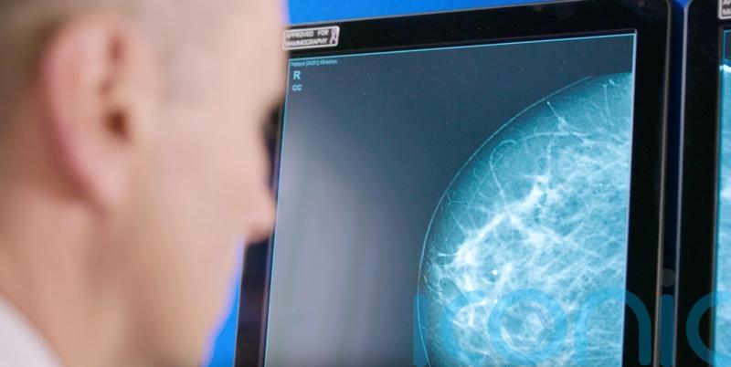 Charity welcomes approval of drug to fight aggressive form of breast cancer