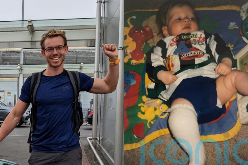 Man with clubfoot told he could never do high-impact sports now completing triathlons to help others with the condition