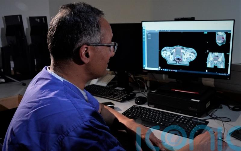 AI could be used to treat more cancers after freeing up radiologists’ time
