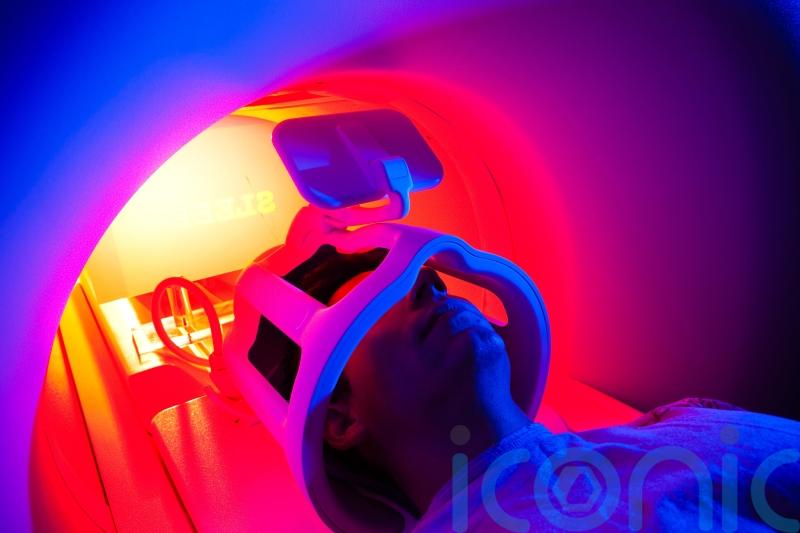 Routine brain scans could pinpoint underlying cause of psychosis, study suggests