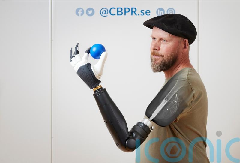 Above-the-elbow amputee ‘moves individual fingers in bionic limb in world first’