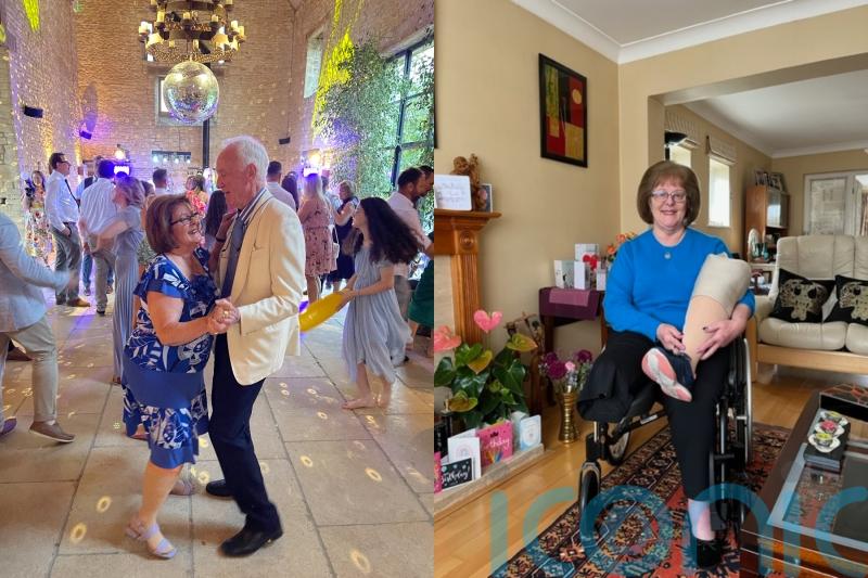 Grandmother who had leg amputated after swollen ankle turned out to be rare cancer can dance again with husband