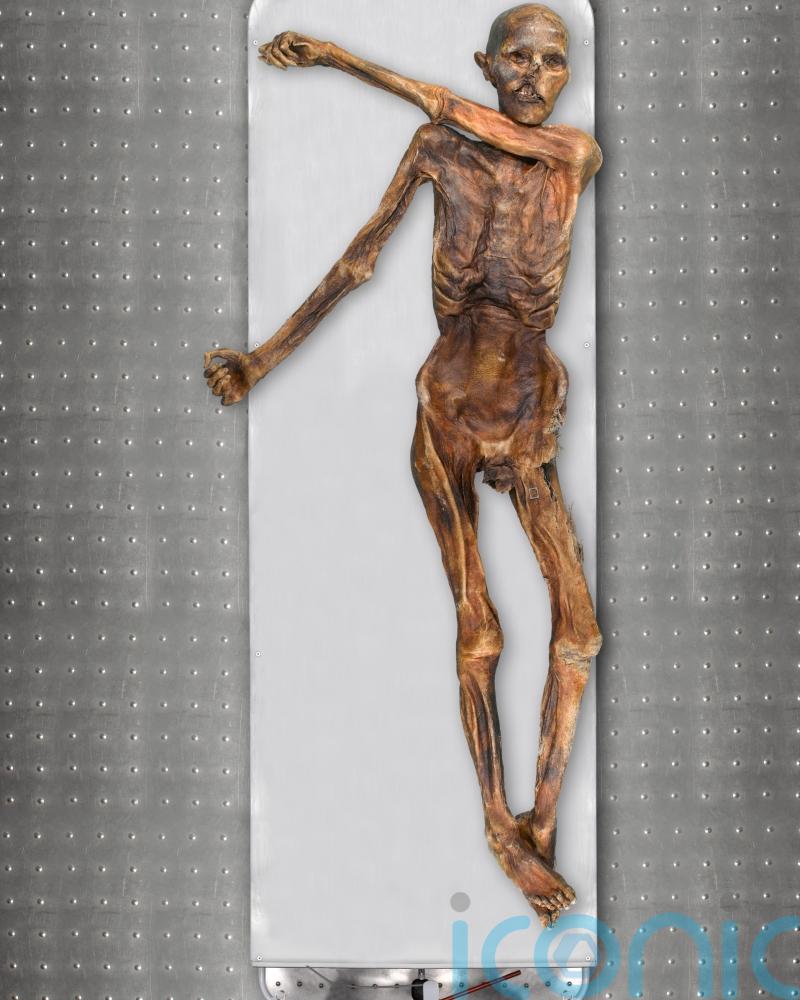 Iceman Otzi had dark skin and male pattern baldness, analysis reveals