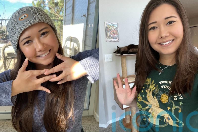 Woman with four digits who identified with Mickey Mouse growing up now using social media to be role model she never had