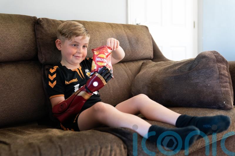 Boy born without a hand gets to grips with new ‘robot arm’