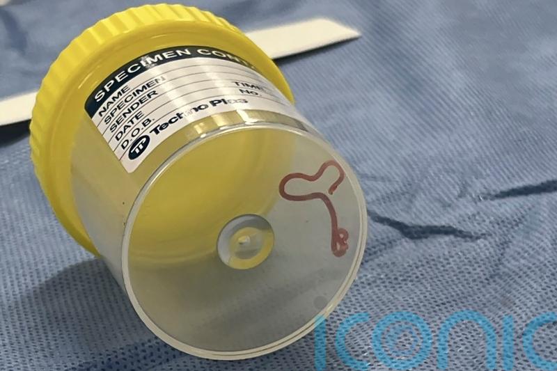 Surgeon probing Australian woman’s mystery symptoms finds live worm in her brain
