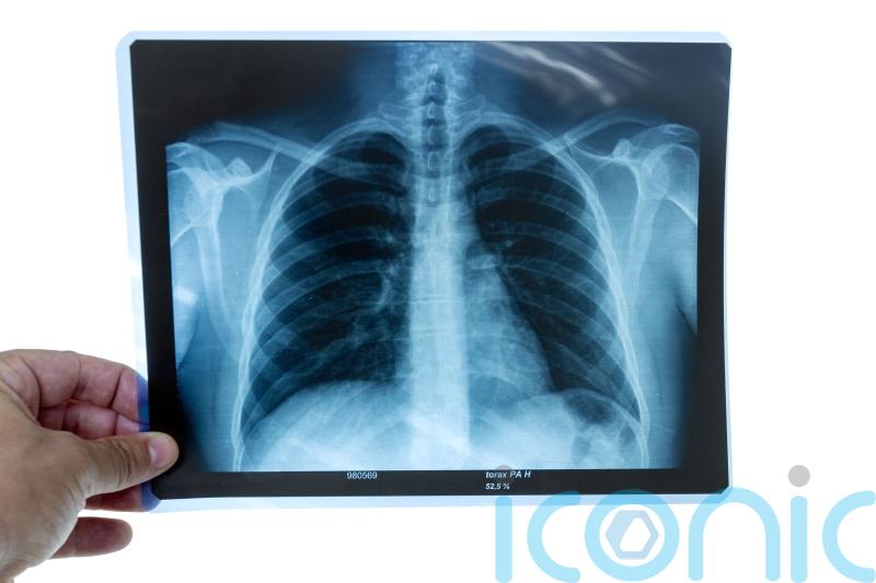 Radiographers to walk out across England in action over pay