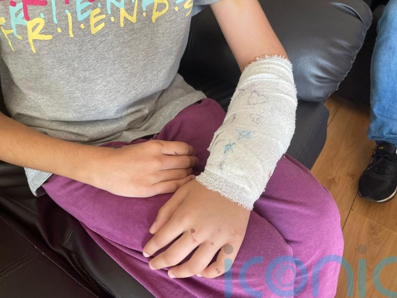 Man arrested after 11-year-old injured in attack by American bully XL dog