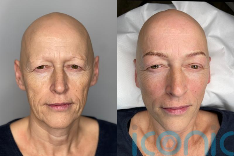 Mum who lost hair twice after chemotherapy and marriage breakdown says ‘life’s for living’ as she embraces 3D eyebrows