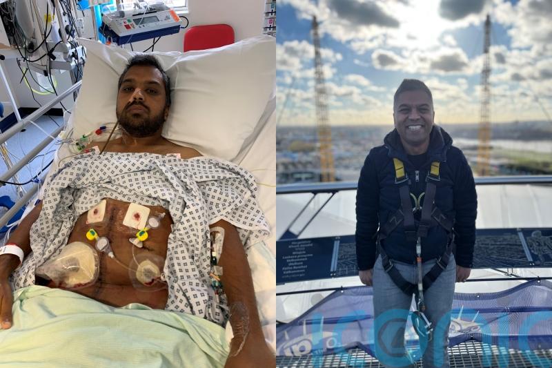 Dad with ‘silent killer’ disease who had double organ transplant during Covid says it was like ‘sci-fi horror film’