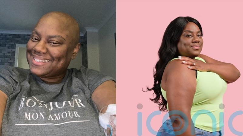 ‘Growing up I did not know black women like me could get cancer – now I’ve had a mastectomy I want to raise awareness’