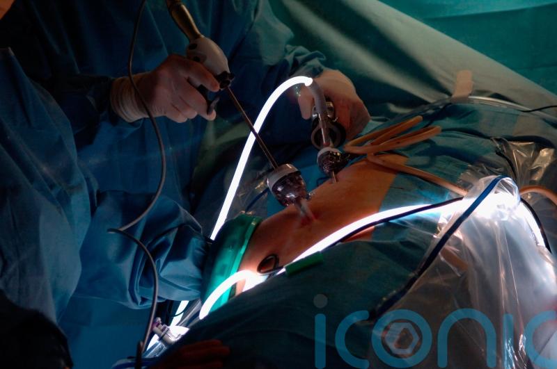 Major advance in transplants as monkey survives two years with pig kidney