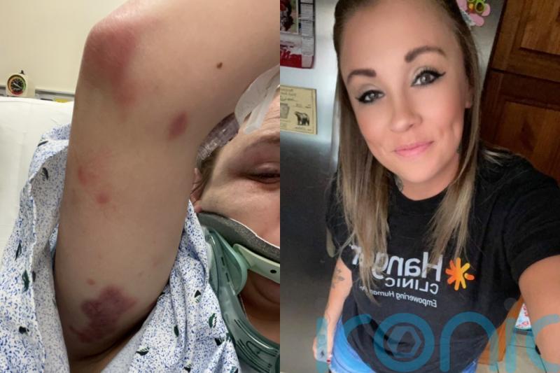 ‘My abusive ex-partner ran me over, leaving me on life support and with one leg, but I’m no longer afraid to speak out’