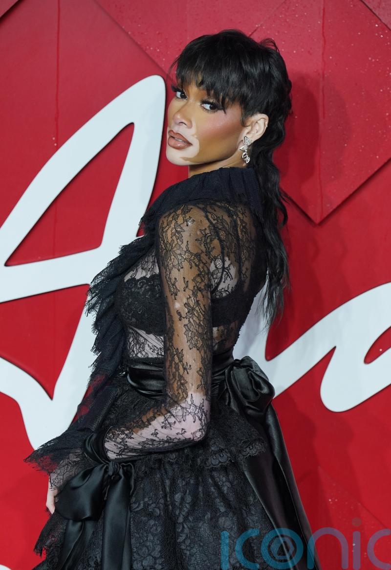 Model Winnie Harlow: ‘There is nothing more magical than feeling seen’