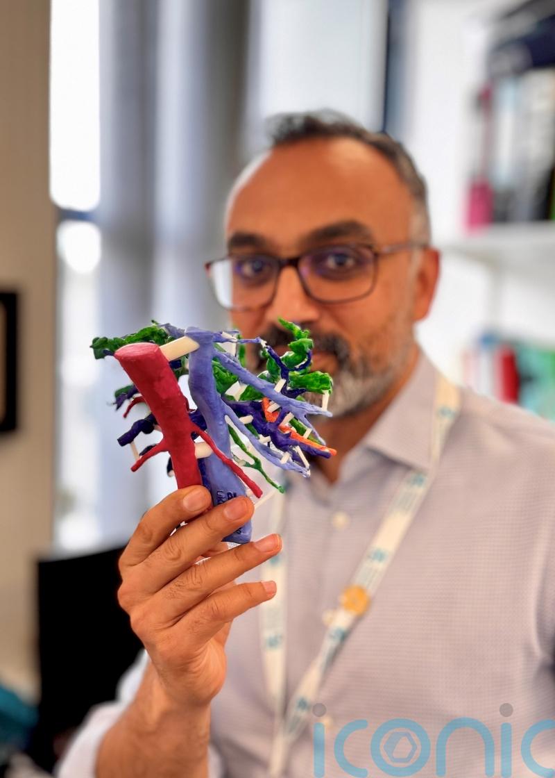 Surgeons develop 3D-printed liver models to plan complex cancer surgery