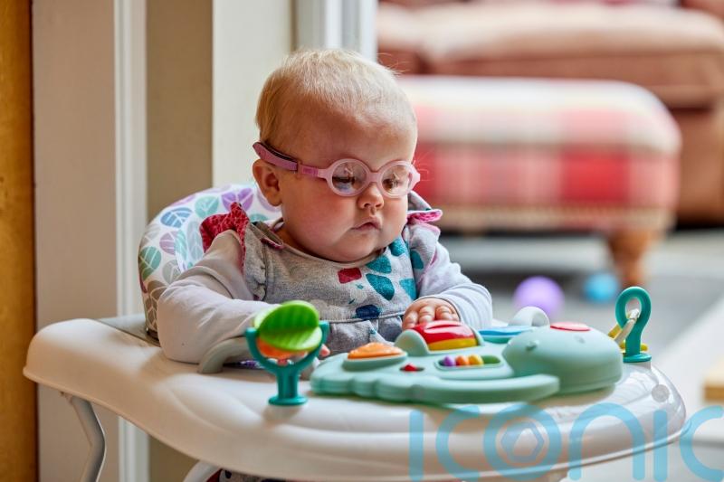 Girl born with no eyes ‘has changed our lives for the better’, say parents