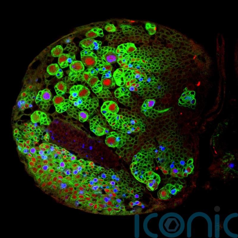 Fruit flies could help scientists stop the growth of brain tumours