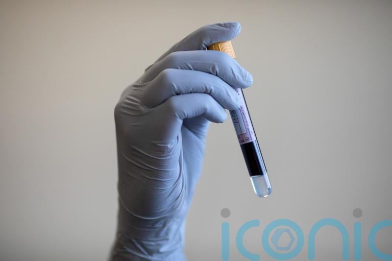 Blood test ‘could identify people at highest risk of dying from heart failure’