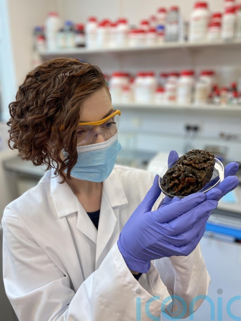 Researchers create new archive of ancient human brains