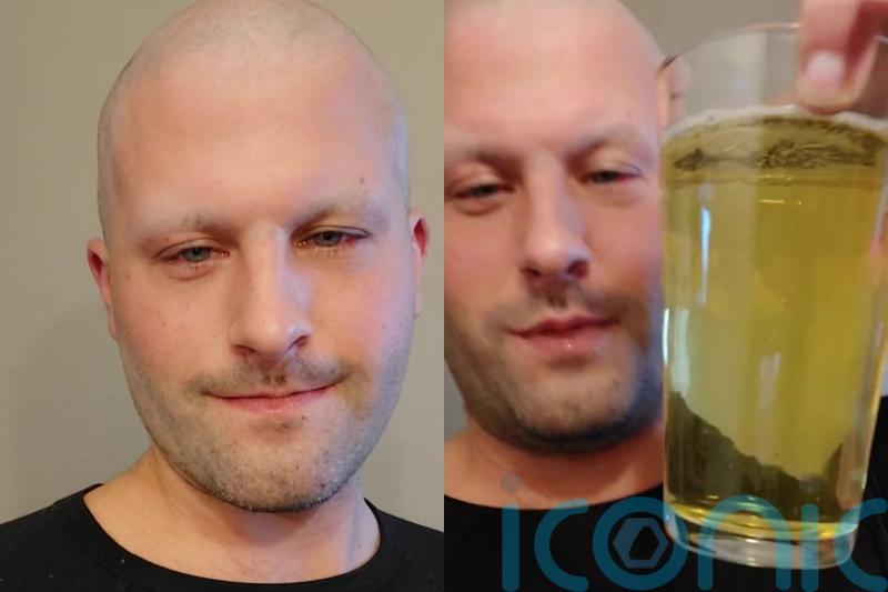 Teacher drinks own urine, bathes in it and rubs it over entire body claiming it helped him process his mum’s death