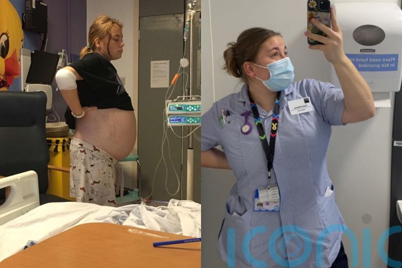 Student told she looked pregnant at 15 finds out extreme swelling was caused by 20cm cancerous tumour on her ovary
