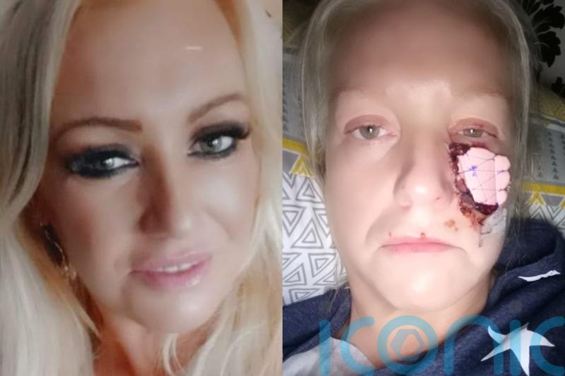 Single mum mauled by friend’s sausage dog which ripped large chunk of cheek off before eating it in front of her