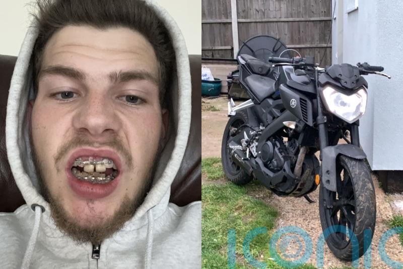 Rider swallows loose tooth after horrendous accident meant doctors had to wire his jaw shut to prevent face collapse