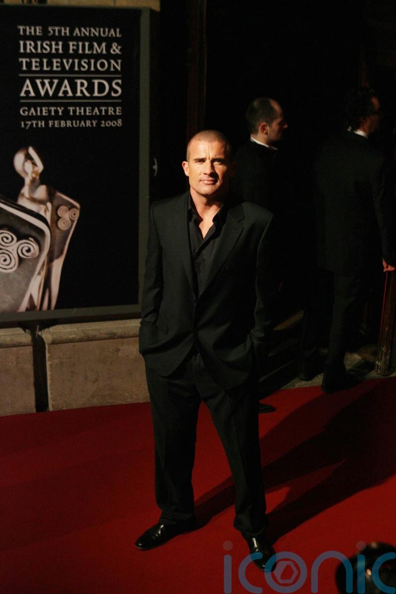 Prison Break star Dominic Purcell reveals on-set accident cracked his skull