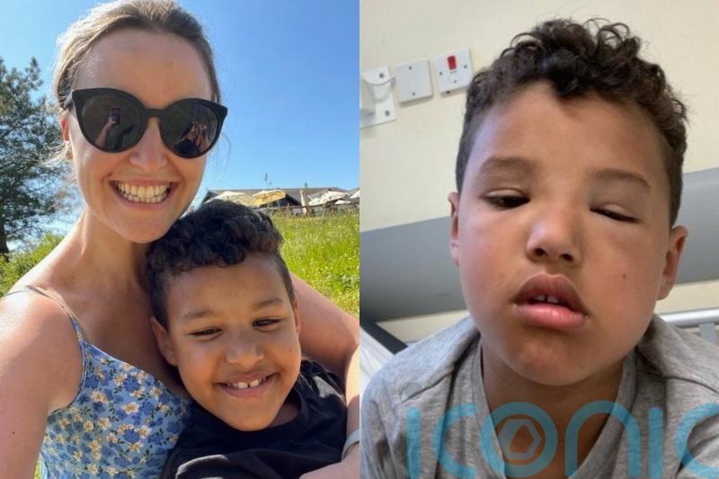 Parents of boy with pea allergy make plea for full lists of ingredients at restaurants after ‘life-threatening’ meal
