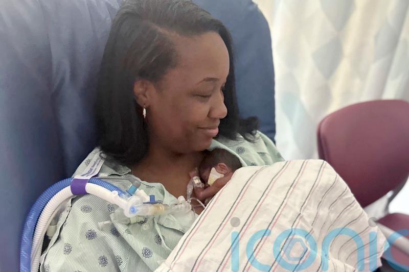 ‘Micropreemie’ baby who weighed 1lb and 1oz at birth goes home from hospital