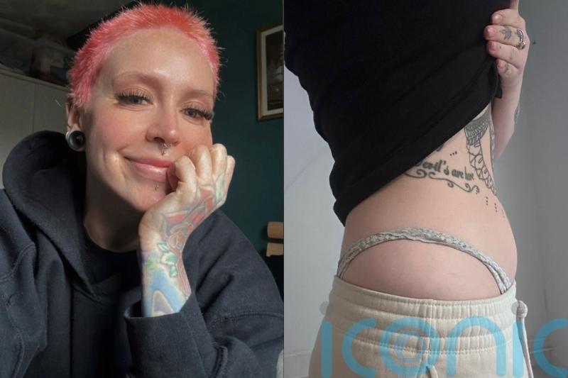 Woman finds huge tumours after being told toilet pain was urinary infection by three doctors during online consultations