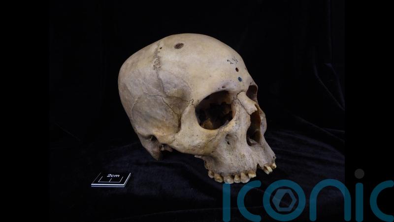 Ancient Egyptians ‘were trying to understand and treat cancer 4,000 years ago’
