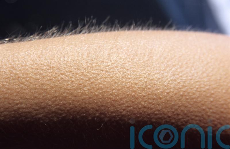 You may get goosebumps far more often than you think – study