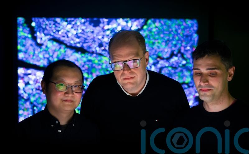AI system learns ‘language of cancer’ to enable improved diagnosis