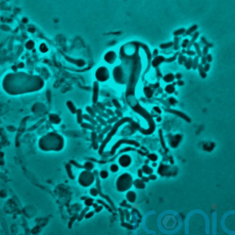 Full list of Greencore products recalled over E. coli fears