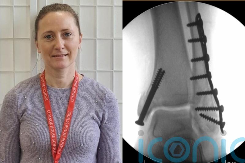 Teacher who suffered horror motorbike crash that shattered ankle into tiny pieces cannot wear high heels six years later
