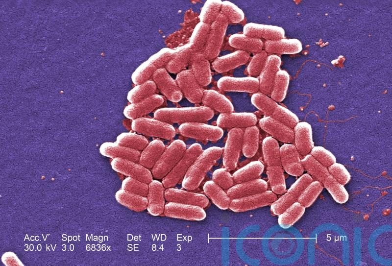 One person dies linked to E.coli outbreak ‘spread by lettuce’